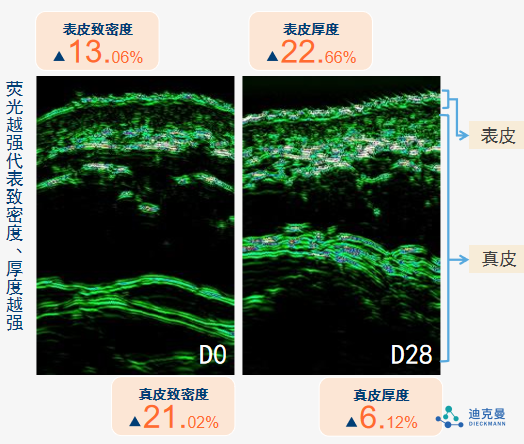 迪克曼生物再添新原料备案：王浆酸神经酰胺(OP)，取得抗光老化新突破！(图9)
